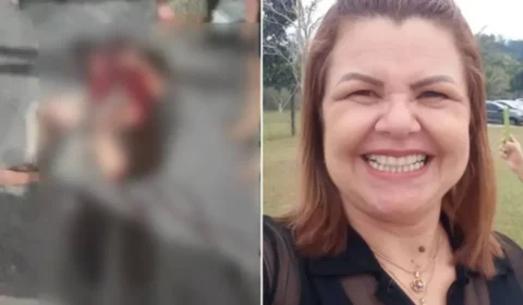 Mulher morre em hospital após ter perna arrancada em acidente no AM