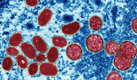 OMS declara que Mpox é uma emergência sanitária global