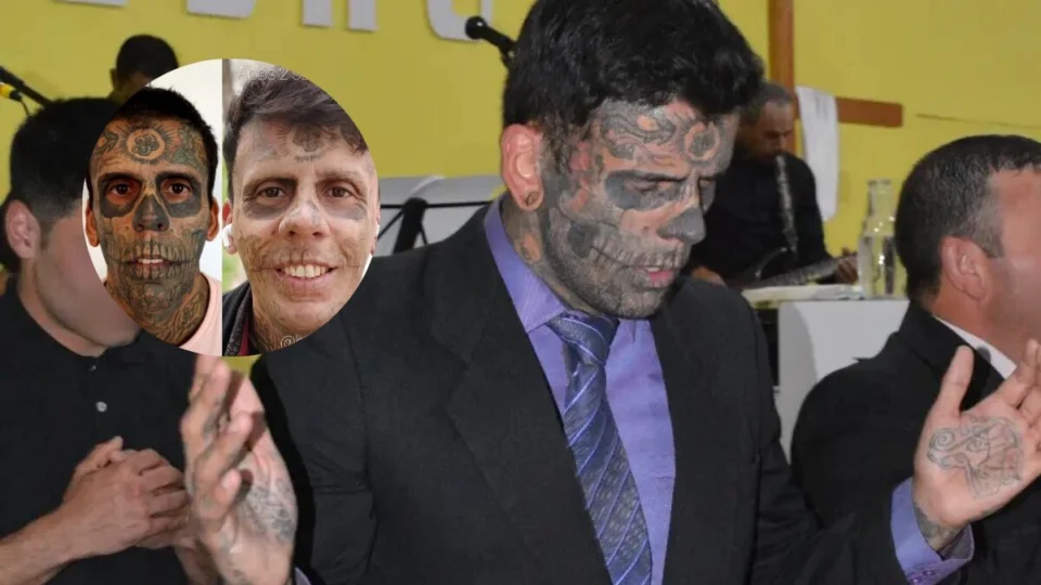 Homem mais tatuado do Brasil remove tattoos; veja antes e depois