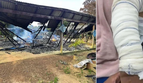 Homem ateia fogo em ex por não aceitar separação, em Cantá