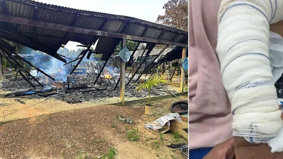 Homem ateia fogo em ex por não aceitar separação, em Cantá