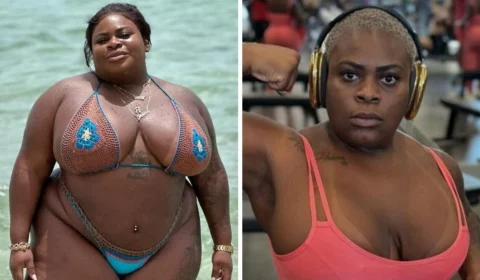Jojo Todynho revela resultado de cirurgias; veja antes e depois