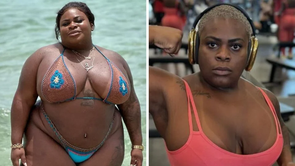 Jojo Todynho revela resultado de cirurgias; veja antes e depois