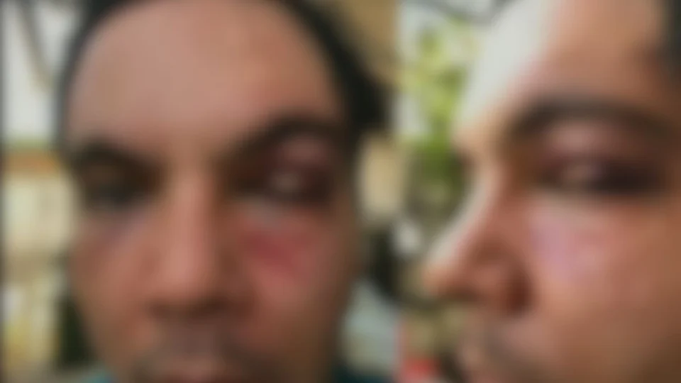 Instituto Mundo Azul fala sobre autista espancado em Manaus: ‘triste realidade’