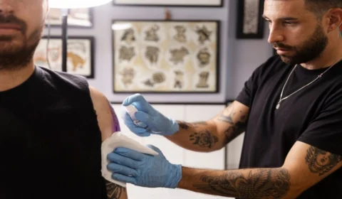 Remoção de tatuagem: saiba como funciona o procedimento