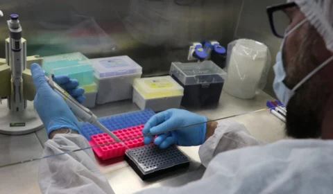 Mpox: Amazonas registra 3 casos confirmados da doença