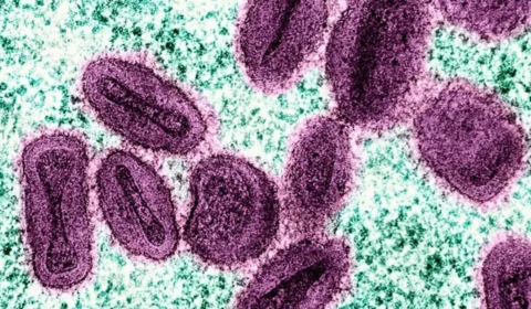 Mpox: Brasil registra mais de 30 novos casos da doença em 15 dias