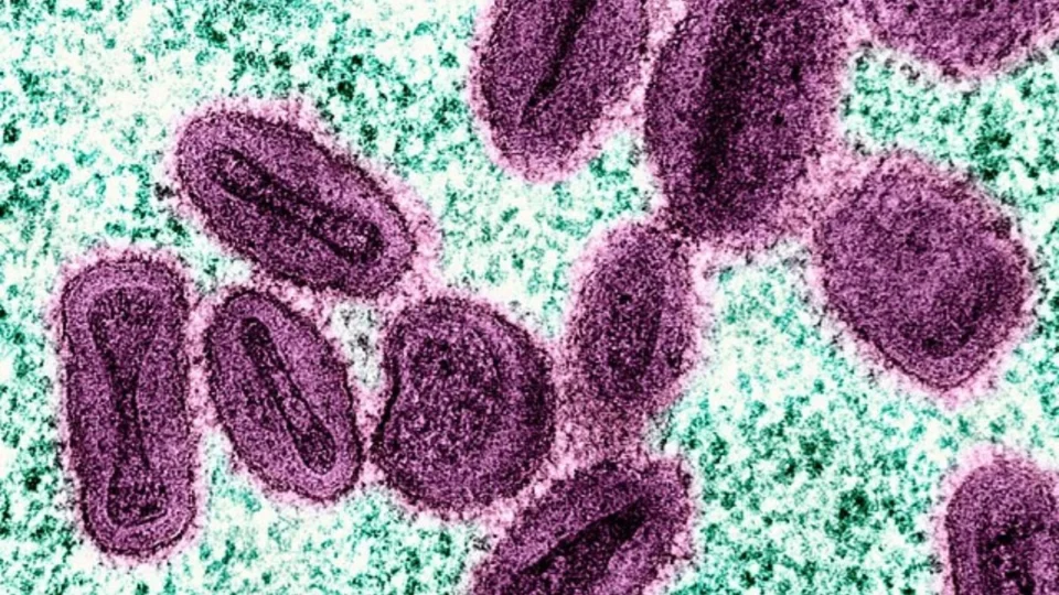 Mpox: Brasil registra mais de 30 novos casos da doença em 15 dias