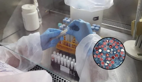 Mpox: aumento expressivo de casos acende alerta no Amazonas