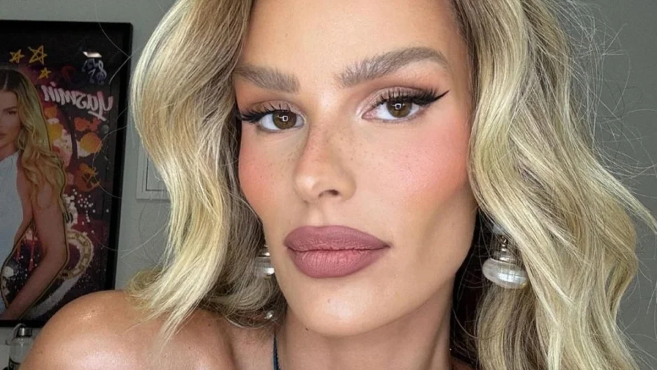 Aparência de Yasmin Brunet vira pauta na web e modelo rebate: ‘falta de noção’