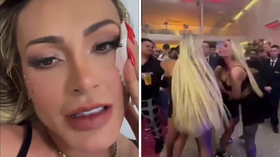 Depois de briga, Andressa Urach expõe rosto ferido por Juju Ferrari