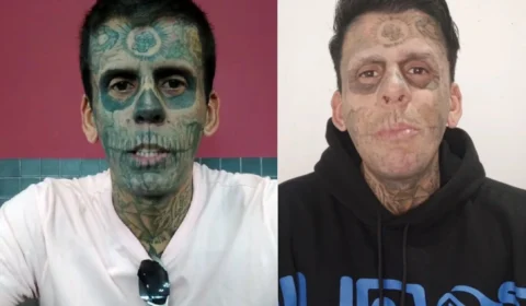 Homem ‘mais tatuado do Brasil’ enfrenta sessões de remoção de tatuagens em busca de recomeço