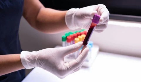 Doença da Vaca Louca: Idoso é internado com suspeita da infecção rara no Brasil