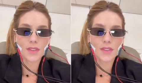 Virginia Fonseca revela disfunção na mandíbula devido a uma cárie; entenda o problema