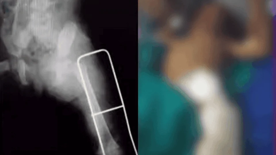 Criança de 1 ano é baleada por PM ‘Bolsonaro’ e é internada em Manaus