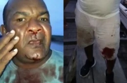 Homem é atacado e agredido com coronhadas por piratas de rio no Amazonas