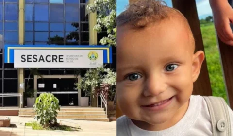 Após morte de bebê que sofreu queimadura e demorou a ser entubado, SESACRE anuncia investigação