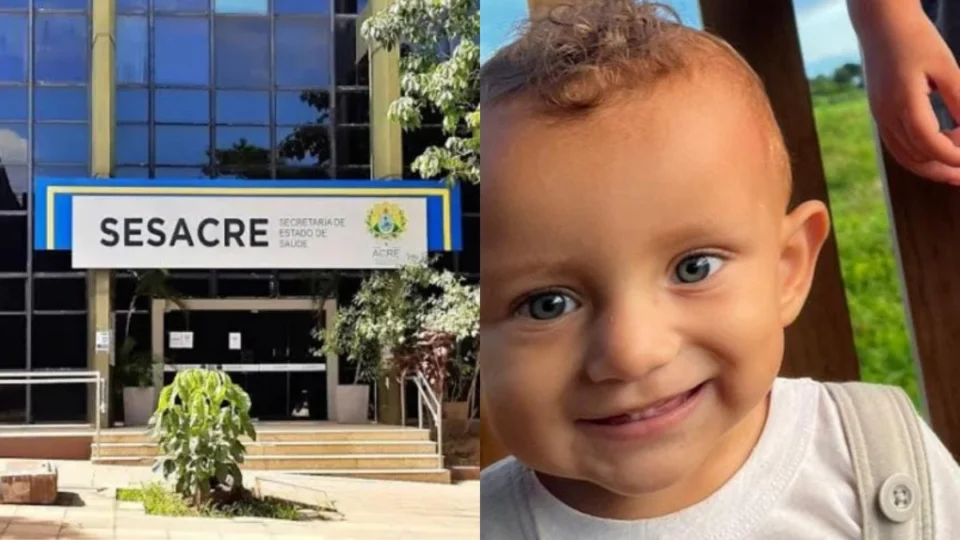 Após morte de bebê que sofreu queimadura e demorou a ser entubado, SESACRE anuncia investigação