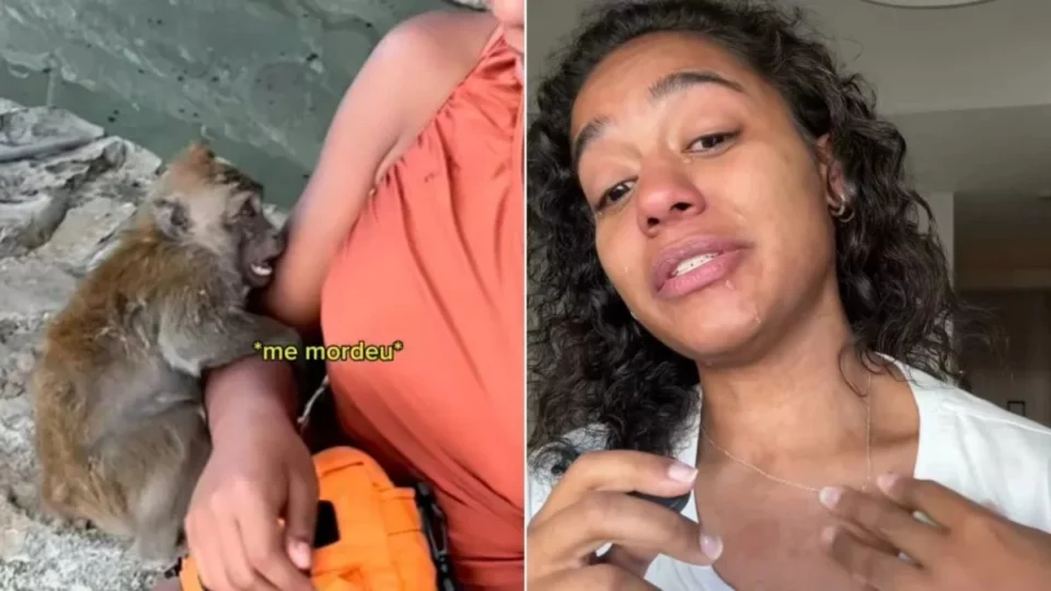 VÍDEO: Influenciadora entra em desespero ao sofrer alergia severa após mordida de macaco na Tailândia