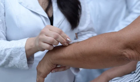 Boa Vista oferta consultas para pacientes com suspeita de hanseníase; veja horários