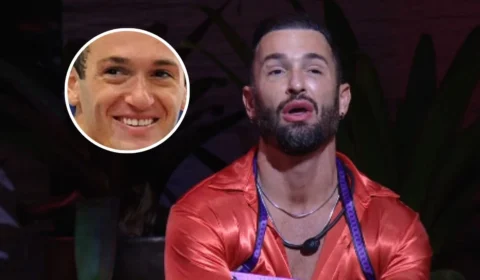 Quanto custou o ‘antes e depois’ de Diego Hypólito? Veja valor médio dos procedimentos