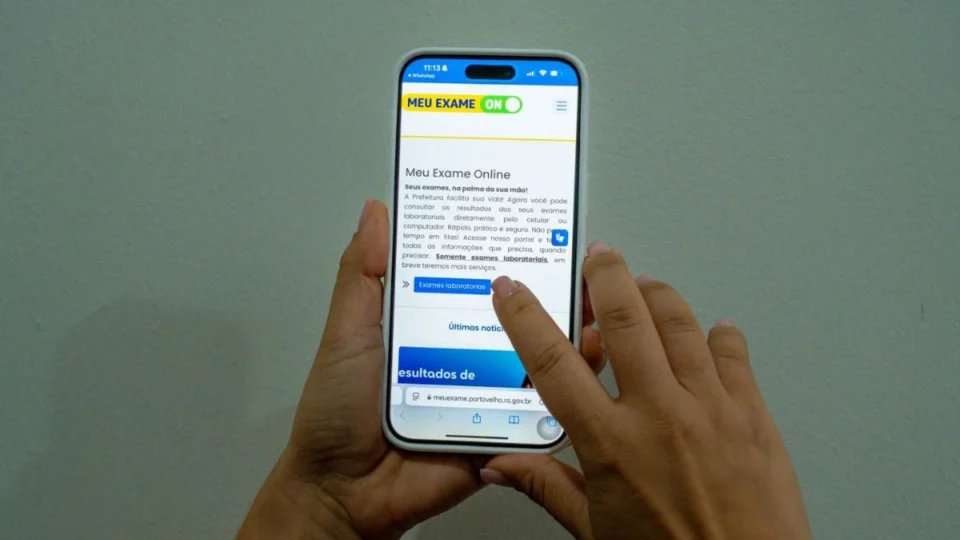 Meu Exame On: saiba como acessar exames laboratoriais do SUS online em Porto Velho