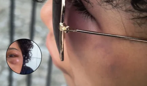 EXCLUSIVO: adolescente foge de cárcere privado após ser espancada junto com filho de 1 ano em Manaus