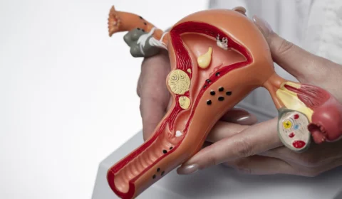 Endometriose tem cura? O que toda mulher precisa saber sobre os sintomas, causas e tratamentos