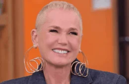 Xuxa revela transplante capilar e diagnóstico de alopecia; como a queda de cabelo afeta mulheres