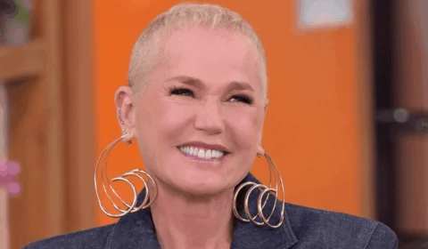 Xuxa revela transplante capilar e diagnóstico de alopecia; como a queda de cabelo afeta mulheres