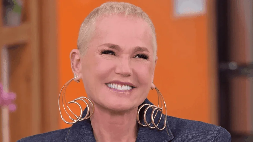 Xuxa revela transplante capilar e diagnóstico de alopecia; como a queda de cabelo afeta mulheres