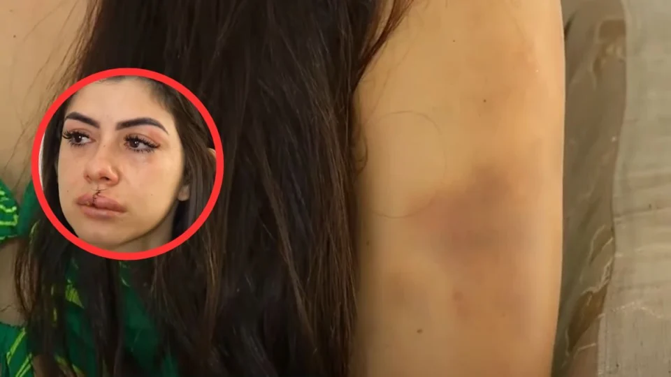 VÍDEO: mulher agredida por cantor em Manaus se emociona com mensagens de apoio