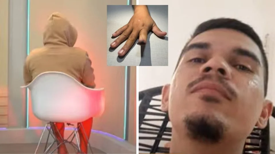 ‘Cuspiu meu dedo e fugiu’: vítima descreve agressão do ex-companheiro em Manaus