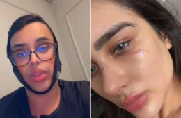 Amigo do ex rebate Miss Amazonas e faz acusação polêmica: ‘Esfaqueou ele’