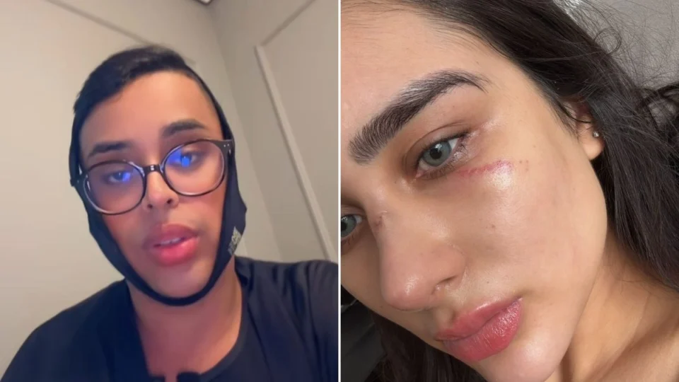 Amigo do ex rebate Miss Amazonas e faz acusação polêmica: ‘Esfaqueou ele’