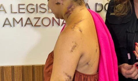 Mulher mostra cortes após ataque do ex em Manaus; filha de 10 meses foi atingida na coxa