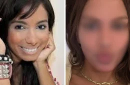 Anitta faz mudança radical no rosto e deixa web em choque: ‘parece que estou vendo outra pessoa’