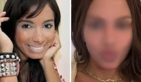 Anitta faz mudança radical no rosto e deixa web em choque: ‘parece que estou vendo outra pessoa’