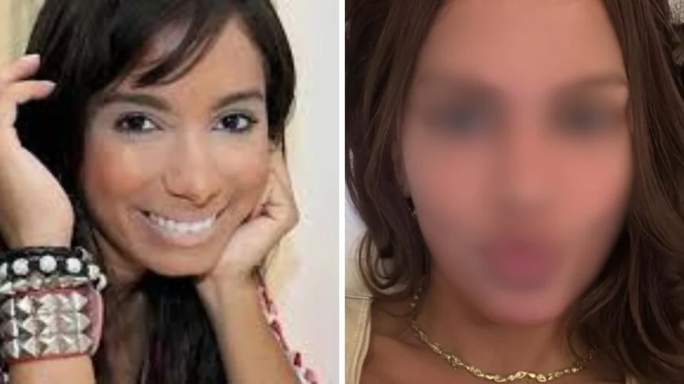 Anitta faz mudança radical no rosto e deixa web em choque: ‘parece que estou vendo outra pessoa’