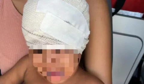 Criança de 2 anos é ferida com pedrada na cabeça durante briga entre vizinhos em Boa Vista