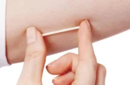 Ministério da Saúde: SUS vai oferecer implante contraceptivo para mulheres em idade fértil