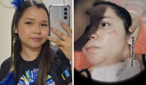 Família de jovem tetraplégica após acidente em Parintins faz vaquinha solidária nas redes