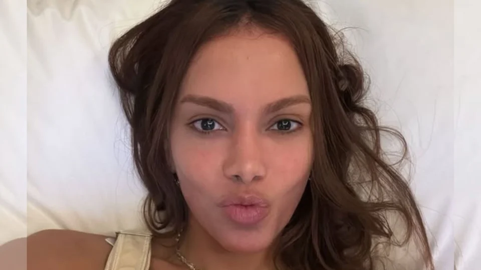 Novo rosto de Anitta: cantora já fez mais de 50 procedimentos estéticos