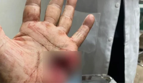 Policial militar de 76 anos atira na própria mão ao limpar arma em Caracaraí