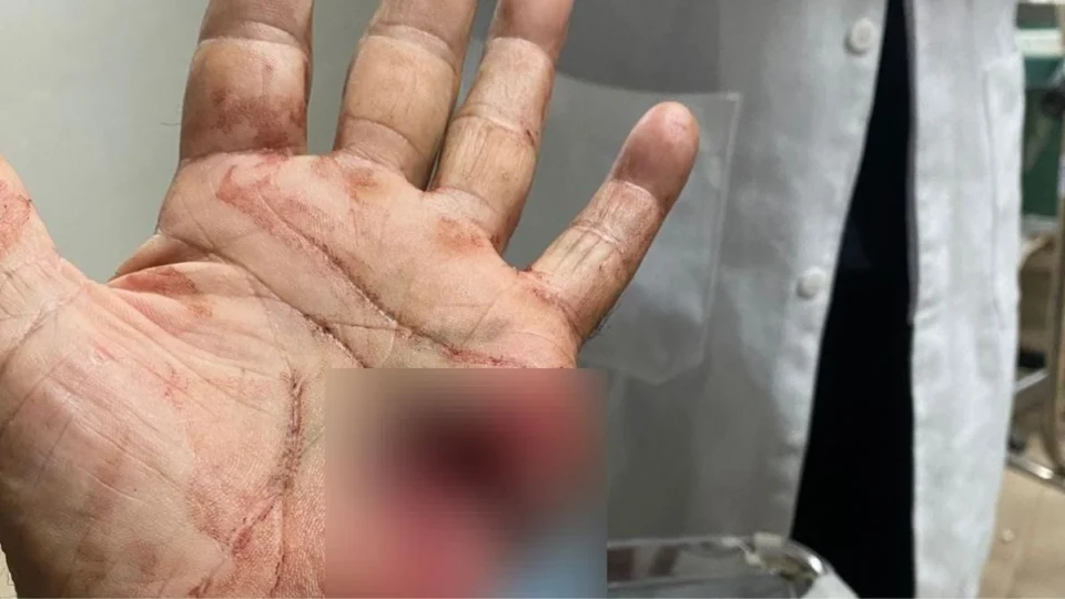 Policial militar de 76 anos atira na própria mão ao limpar arma em Caracaraí