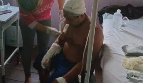 VÍDEO: Onça ataca cacique no Amazonas e o deixa com ferimentos graves na cabeça; confira