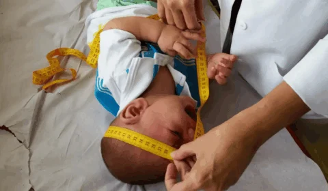 Indenização de R$ 50 mil e pensão vitalícia começam a ser pagas a famílias afetadas pelo Zika