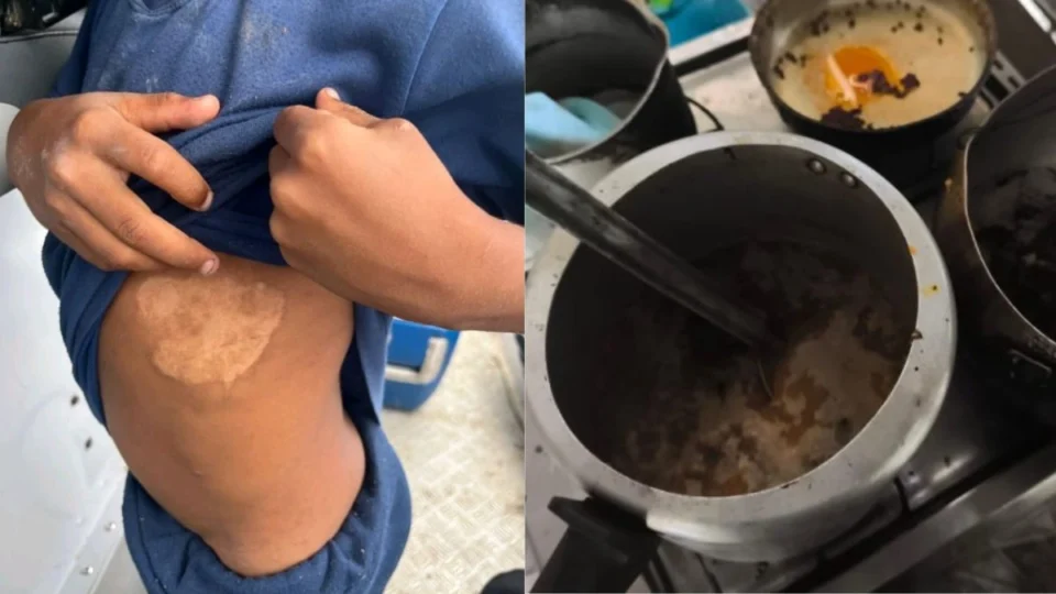 Irmãos de 7 e 8 anos são resgatados em Roraima após denúncia de maus-tratos