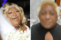 Patixa exibe sorrisão renovado e mostra novo resultado dos dentes; veja fotos