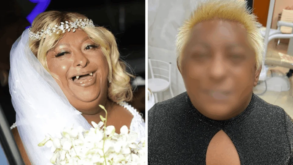 Patixa exibe sorrisão renovado e mostra novo resultado dos dentes; veja fotos